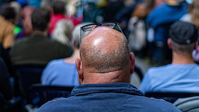 Adiós calvicie: este es el champú anticaída para hombre más vendido en Alemania.