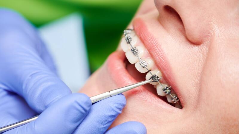 Excelente noticia del Gobierno para los mayores de 65: podrán acceder a tratamientos dentales gratis. (Imagen: archivo)