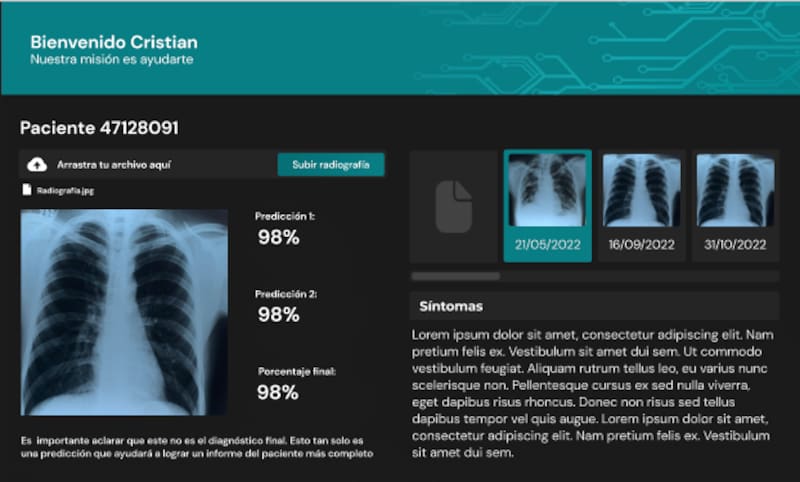 Preview del modelo IARA. (Foto: gentileza).