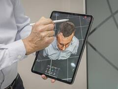 Nueva era en recuperación capilar: Hair Recovery aplica IA a la caída del cabello