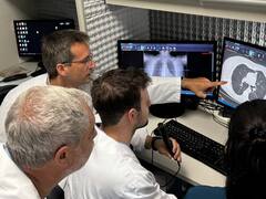 Impulsan la teleradiología para la detección temprana del cáncer de pulmón en regiones remotas del país