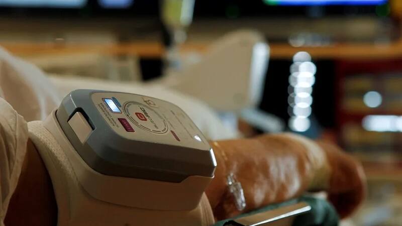 El hallazgo científico que inquieta a los científicos: microplásticos en las arterias del cuello.