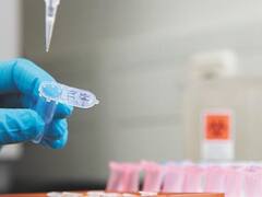 Estudio argentino con plasma logró un 61% de efectividad