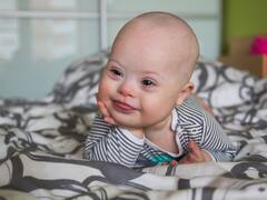 España es el país con la mayor tasa de interrupciones de embarazos por Síndrome de Down, ¿cuáles son los motivos?