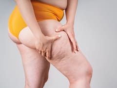 El truco secreto para tener unas piernas soñadas sin celulitis, estrías ni flacidez