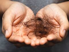 Ni en primavera ni en verano: por qué el pelo se cae más en otoño y cómo evitarlo
