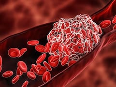 La enfermedad invisible que mata a una persona cada 6 minutos, pero se puede prevenir