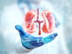 Es especialista en riñones, reveló cuál es la mayor causal de las piedras en este órgano y cómo prevenirlas