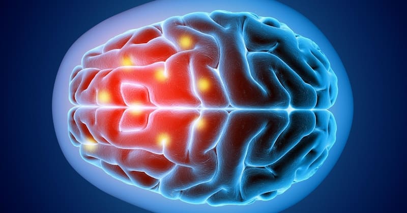 La meningitis es una grave enfermedad cerebral. (Foto: El Debate).