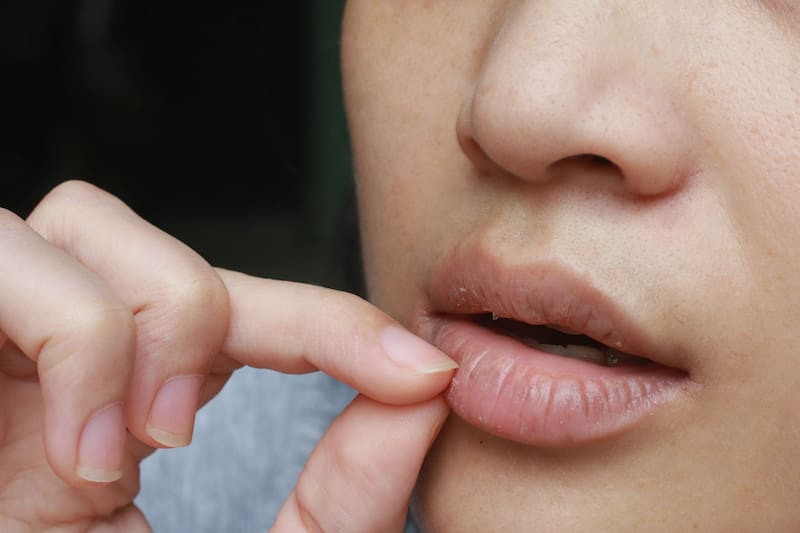 Estos remedios caseros naturales son ideales para hidratar y proteger los labios. (Fuente: Shutterstock)