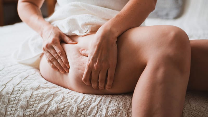 Dormir bien es esencial para reparar los daños en la piel y prevenir la aparición de celulitis. (Foto:Shutterstock)