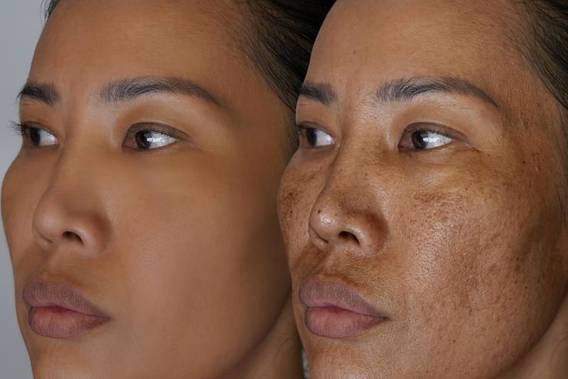 Limpieza facial. Fuente: Shutterstock.