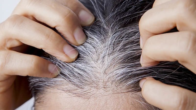 Las canas surgen cuando los folículos dejan de producir melanina, el pigmento que da color al cabello. Imagen: archivo.