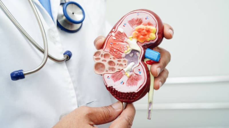 Los problemas en los riñones son de las complicaciones médicas que más comúnmente se desarrollan con el paso de los años, en especial la formación de cálculos o "piedras".
