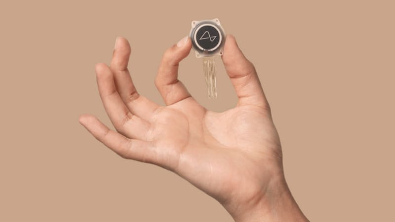 Implante cerebral de Neuralink.