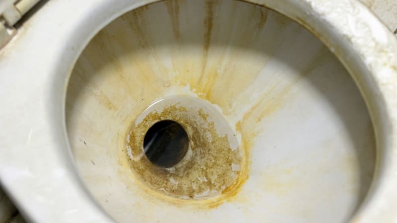 Para aplicar este método y dejar el inodoro como nuevo, solo hay que seguir unos sencillos pasos. Foto: Magnific.