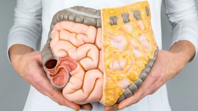 Expertos recomiendan la dieta perfecta para reducir el hígado graso y mejorar el sistema digestivo