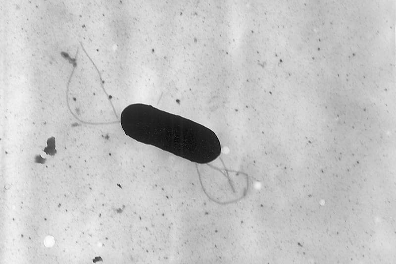 Imagen de la Listeria monocytogenes, bacteria que puede provocar listeriosis. (Fuente: Wikimedia Commons)