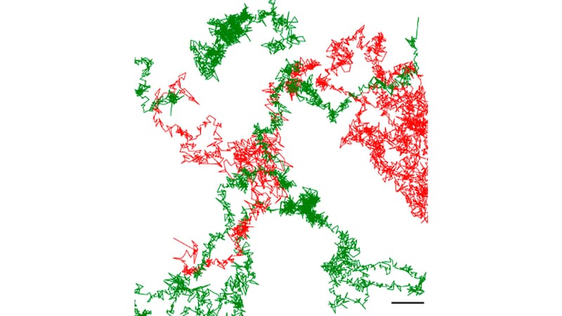Imágenes de IA con el microscopio de superresolución.