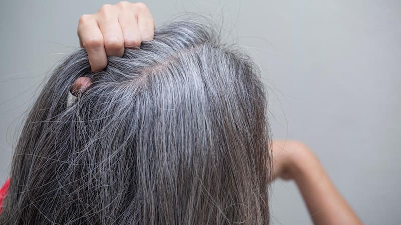 Adiós a las canas para siempre: el truco casero para recuperar el color y brillo natural del cabello sin químicos.