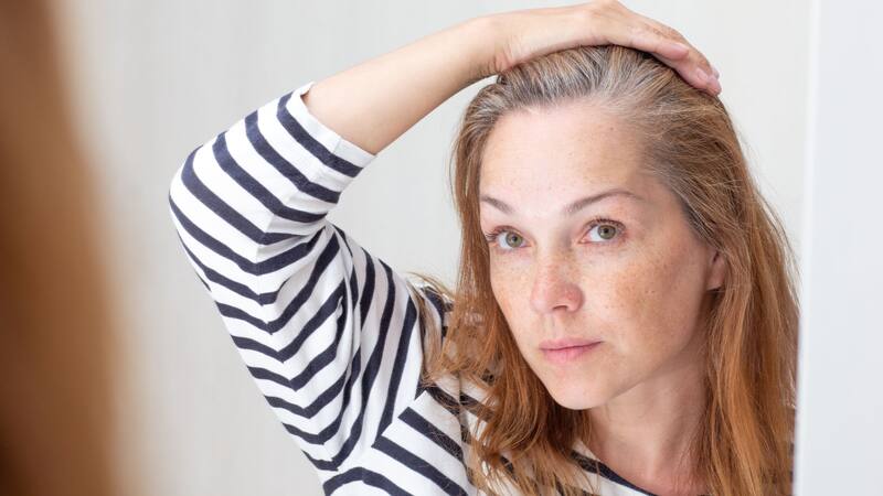 La aparición de canas puede ser vista como una oportunidad para educar a los pacientes sobre la aceptación del envejecimiento natural.