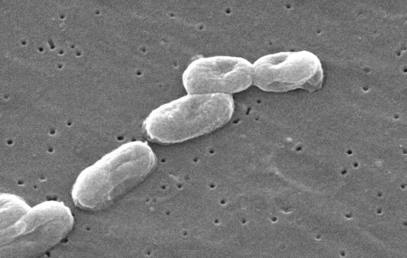 La bacteria Burkholderia cepacia puede causar infecciones en personas con problemas respiratorios (Fuente: Wikimedia Commons / CDC / Janice Carr Content Providers)