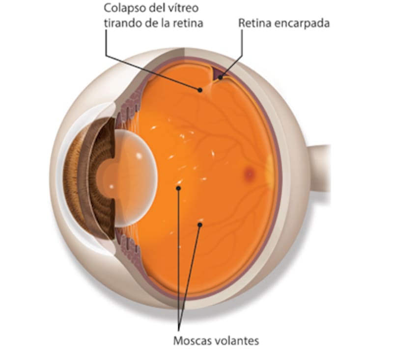 American Academy of Ophthalmology.