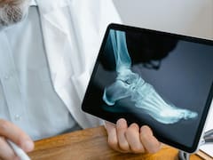 Oro blanco: el tesoro oculto que está en todas las cocinas, fortalece tus huesos, protege el corazón y recupera la energía pérdida