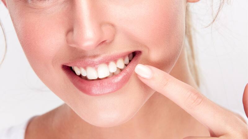 Los cinco remedios naturales para blanquear los dientes y tener una sonrisa brillante siempre.