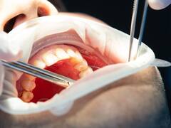 El fin de los dentistas | China creó un líquido regenerador de dientes con solo 2 gotas