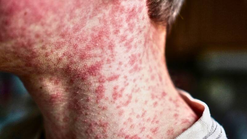 <div class="migrated-promo-image__description"><div class="migrated-promo-image__source">Fuente: Archivo</div></div>