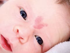 El misterio detrás de las marcas de nacimiento: ¿mensajes ocultos de vidas pasadas?