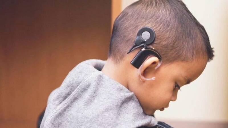 La detección temprana de la hipoacusia es fundamental para el desarrollo adecuado del lenguaje en los niños. (Foto: salta.gob.ar)