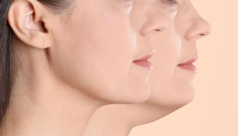 Esta técnica tiene como objetivo fortalecer los músculos faciales, mejorar la elasticidad de la piel y prevenir la flacidez. Fuente: Shutterstock.