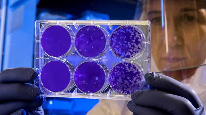 Desde una universidad de Japón dieron con esta proteína anti edad.