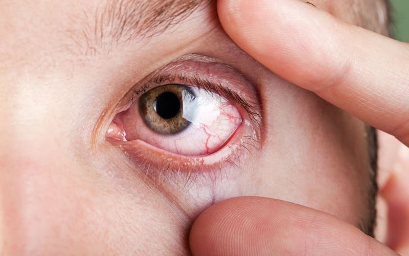Científicos españoles descubren una sustancia química que frena el desarrollo del glaucoma. (Imagen: archivo)