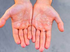 Adiós manos resecas: cómo cuidar la piel durante la ola polar