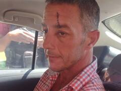 La insólita justificación del hombre que le tiró un botellazo al presidente Milei: "No quise..."