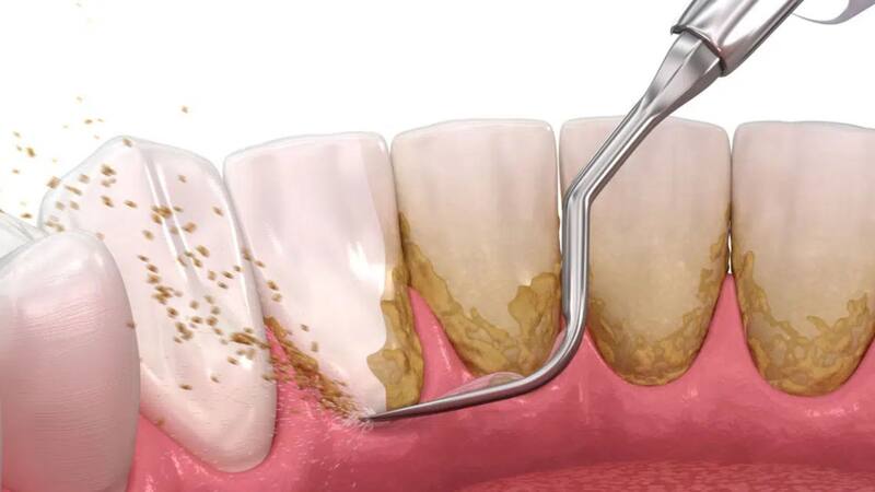 <div class="migrated-promo-image__description"><div class="migrated-promo-image__source">Fuente: Archivo</div></div>