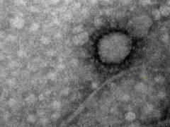 Cómo es la primera foto del coronavirus que está en el país