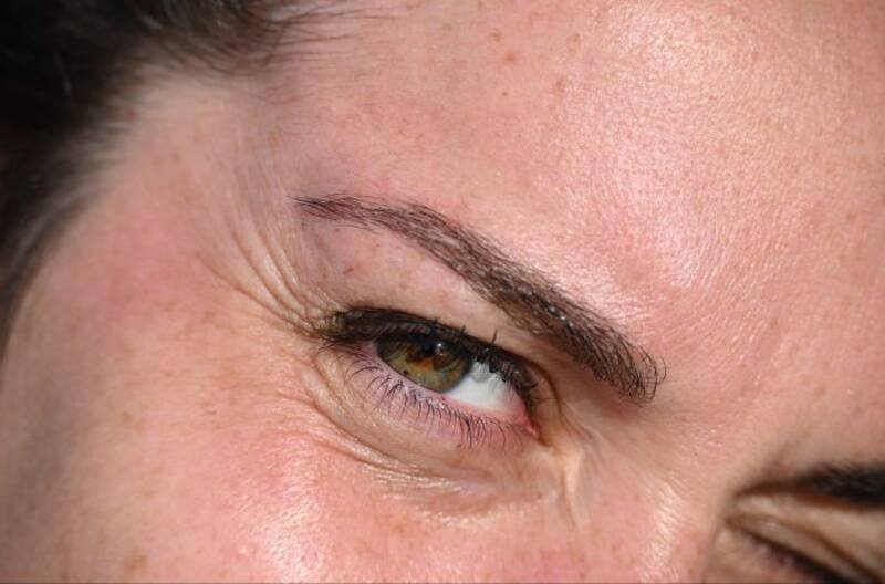 Adiós patas de gallo: remedios naturales efectivos para eliminarlas (foto: archivo).
