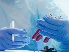 Cambia la ciencia para siempre: tras más de 50 años, descubren un nuevo grupo de sangre