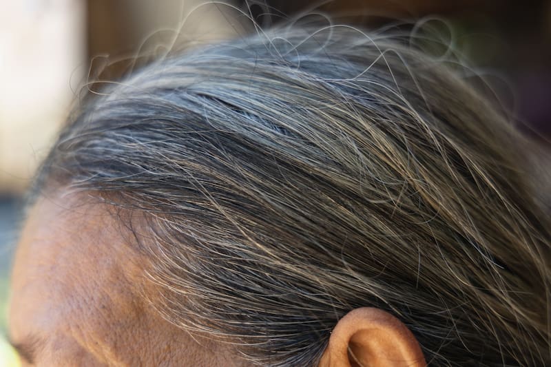 El factor que contribuye a la aparición de canas. Fuente: Shutterstock.