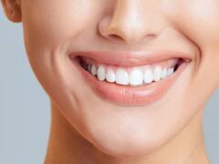 Odontología: ¿cuánto cuesta hacerse un implante en Argentina?