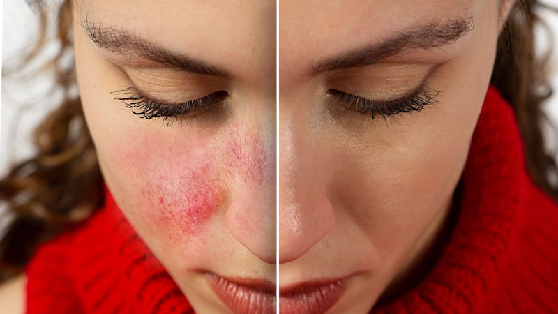 <div class="migrated-promo-image__description"><div class="migrated-promo-image__source">Fuente: Shutterstock</div></div>