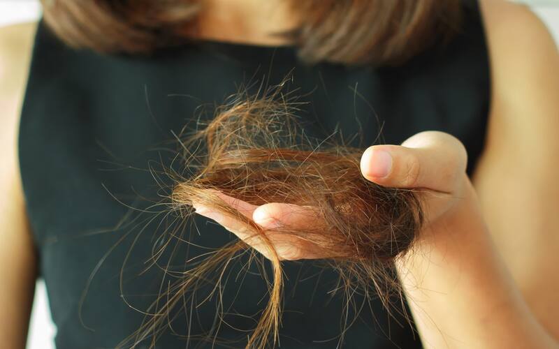 Los folículos pilosos se debilitan después de que el paciente se expone a una temperatura alta.