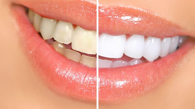 <div class="migrated-promo-image__description"><div class="migrated-promo-image__source">Fuente: Shutterstock</div></div>