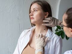 Cáncer de piel: reconoce los lunares peligrosos