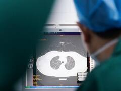 Alerta COVID: la alarmante secuela que deja el coronavirus en uno de cada cuatro pacientes