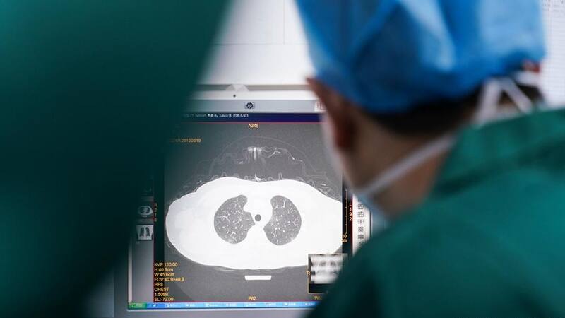 Alerta COVID: la alarmante secuela que deja el coronavirus en uno de cada cuatro pacientes